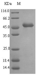 [0399-CSB-EP318584EZX-02] Recombinant Pseudomonas aeruginosa Elastase (lasB) - 100 µg